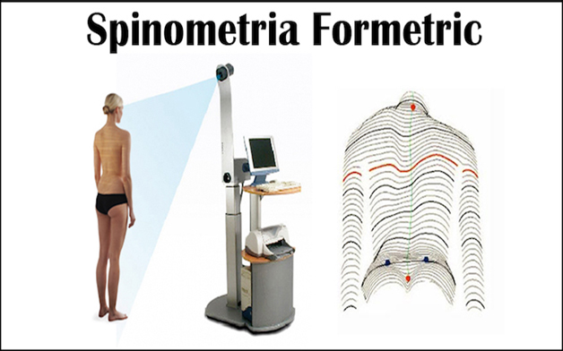 Spinometria Formetric